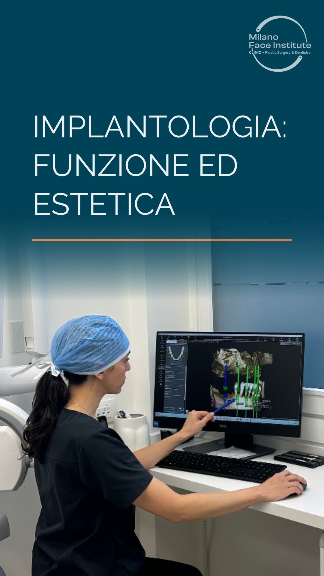 Implantologia su misura: dal dente perso al nuovo sorriso
