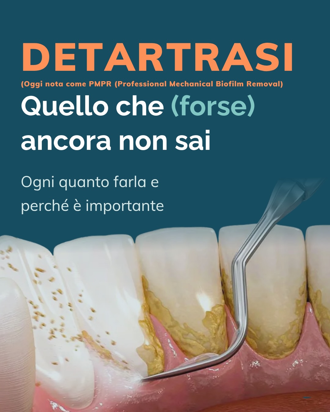 Detartrasi.