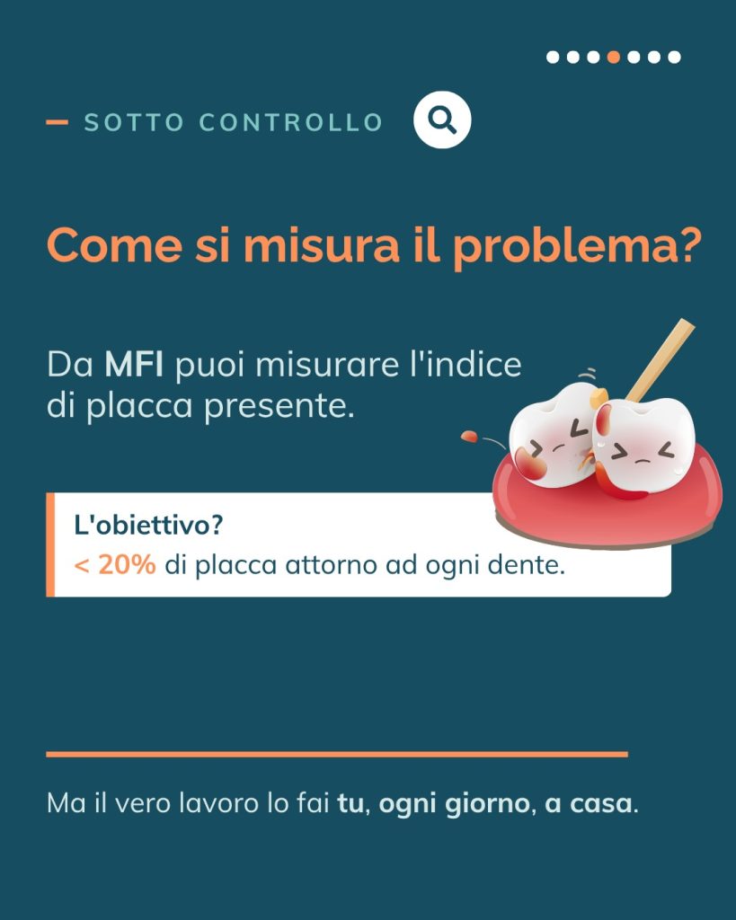 Detartrasi.